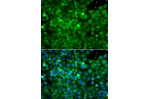 Immunofluorescence analysis of A549 cells using POC1A antibody (ABIN6293867).
