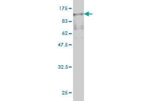 Western Blot detection against Immunogen (89. (Radixin antibody  (AA 1-583))