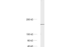 Western Blotting (WB) image for anti-Early Endosome Antigen 1 (EEA1) (AA 2-13) antibody (ABIN1742484) (EEA1 antibody  (AA 2-13))