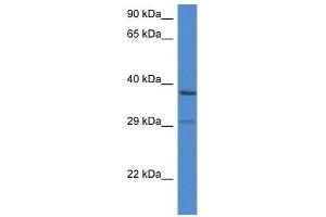 Western Blot showing OGG1 antibody used at a concentration of 1 ug/ml against ACHN Cell Lysate (OGG1 antibody  (C-Term))