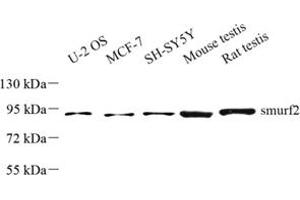 Western blot analysis of smurf2 (ABIN7075626) at dilution of 1: 500