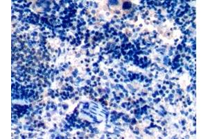 #VALUE! (BID antibody  (AA 1-196))