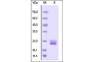 Biotinylated Mouse VEGF120, His,Avitag on  under reducing (R) condition. (VEGFA Protein (AA 27-146) (His tag,AVI tag,Biotin))