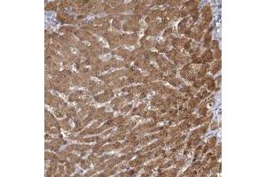 Immunohistochemical staining (Formalin-fixed paraffin-embedded sections) of human liver with CNTLN polyclonal antibody  shows moderate cytoplasmic and nuclear positivity in hepatocytes. (CNTLN antibody)