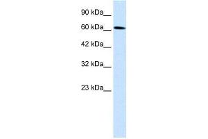 Human Daudi; WB Suggested Anti-UBP1 Antibody Titration: 0. (TFCP2 antibody  (Middle Region))