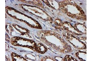 Immunohistochemical staining of paraffin-embedded Human Kidney tissue using anti-PSMB9 mouse monoclonal antibody.