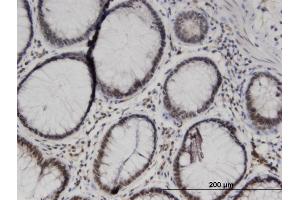 Immunoperoxidase of monoclonal antibody to TCEA1 on formalin-fixed paraffin-embedded human colon. (TCEA1 antibody  (AA 81-185))