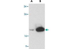 Western blot analysis of (A) 25 and (B) 125 ng of LY96 recombinant protein with LY96 monoclonal antibody, clone 9F1B1  at 1 ug/mL . (LY96 antibody  (AA 2-160))