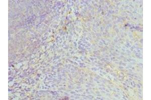 Immunohistochemistry of paraffin-embedded human tonsil tissue using ABIN7174029 at dilution of 1:100 (HCK antibody  (AA 1-220))