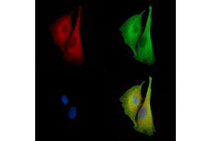 ABIN7096905 and ABIN7100971 staining  cells by IF/ICC.