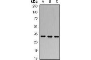 Western blot analysis of FHL-1 expression in 22RV1 (A), MCF7 (B), mouse kidney (C) whole cell lysates. (FHL1 antibody)