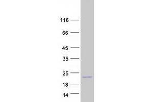 Validation with Western Blot