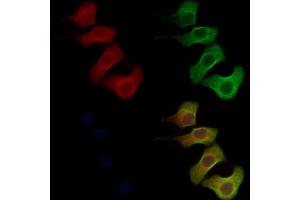 ABIN6258902 and ABIN6276276 staining Hela cells by IF/ICC.