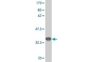 Western Blot detection against Immunogen (36. (FLT4 antibody  (AA 34-133))