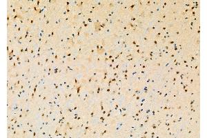 ABIN6260475 and ABIN6277853 at 1/100 staining Mouse brain tissue by IHC-P.