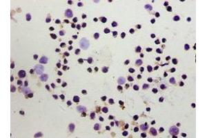 Immunohistochemistry of paraffin-embedded Hela cells using ABIN7153097 at dilution of 1:100 (FOXP3 antibody  (AA 1-260))