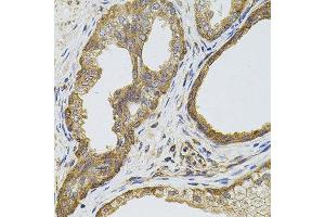 Immunohistochemistry of paraffin-embedded human prostate using EGFR antibody. (EGFR antibody  (AA 1021-1210))