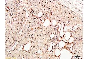 Immunohistochemistry (Paraffin-embedded Sections) (IHC (p)) image for anti-Platelet/endothelial Cell Adhesion Molecule (PECAM1) (AA 601-680) antibody (ABIN669006)