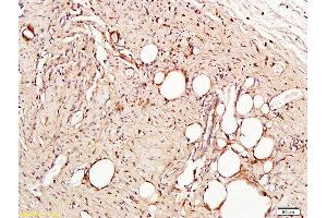 Formalin-fixed and paraffin embedded rat skin tissue labeled with Anti-CD31/PECAM-1 Polyclonal Antibody, Unconjugated  at 1:300, followed by conjugation to the secondary antibody and DAB staining (CD31 antibody  (AA 601-680))