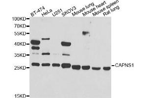 Western blot analysis of extracts of various cell lines, using CAPNS1 antibody. (Calpain S1 antibody)
