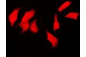 Immunofluorescent analysis of CSN1 staining in SKOV3 cells. (GPS1 antibody)