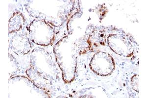 Formalin-fixed, paraffin-embedded human Prostate stained with Cytokeratin 15 Rabbit Recombinant Monoclonal Ab (KRT15/2103R). (Recombinant KRT15 antibody)