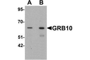 Western blot analysis of GRB10 in SK-N-SH cell lysate with GRB10 Antibody  at (A) 1 and (B) 2 µg/ml. (GRB10 antibody  (C-Term))