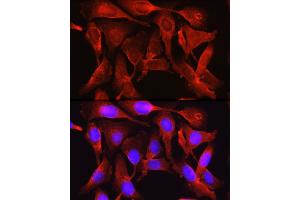 Immunofluorescence (IF) image for anti-Proprotein Convertase Subtilisin/kexin Type 9 (PCSK9) (C-Term) antibody (ABIN6145328)