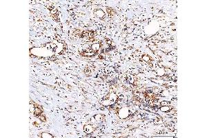 IHC analysis of EML4 using anti-EML4 antibody (ABIN6719384). (EML4 antibody  (AA 207-423))