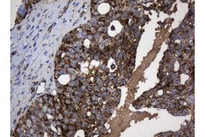 Image no. 4 for anti-NADH Dehydrogenase (Ubiquinone) 1 beta Subcomplex, 10, 22kDa (NDUFB10) antibody (ABIN1499672) (NDUFB10 antibody)