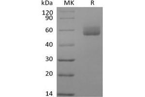 Western Blotting (WB) image for Glycosylphosphatidylinositol Anchored High Density Lipoprotein Binding Protein 1 (GPIHBP1) protein (Fc Tag) (ABIN7319833) (GPIHBP1 Protein (Fc Tag))