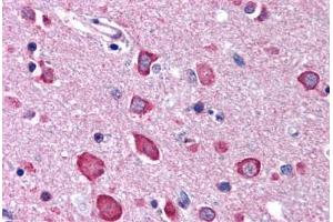 Brain, cortex (BRSK1 antibody  (C-Term))