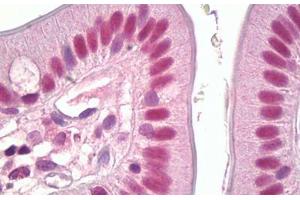 Anti-MSK1 antibody IHC staining of human small intestine. (MSK1 antibody  (AA 331-380))
