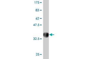Western Blot detection against Immunogen (31. (DAZ3 antibody  (AA 387-438))