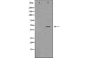 Western blot analysis of T47D  lysate using NCF1 antibody.
