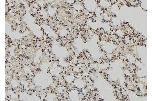 ABIN6279694 at 1/100 staining Rat lung tissue by IHC-P. (PPP1R2P3 antibody)