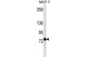Western Blotting (WB) image for anti-ATP-Binding Cassette, Sub-Family B (MDR/TAP), Member 10 (ABCB10) antibody (ABIN3002510) (ABCB10 antibody)