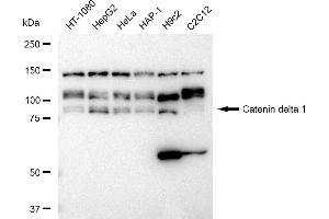 Western blotting analysis using Catenin delta 1 antibody (ABIN7797934).