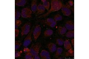 Immunofluorescence staining of methanol-fixed Hela cells using GATA1(Phospho-Ser142) Antibody. (GATA1 antibody  (pSer142))