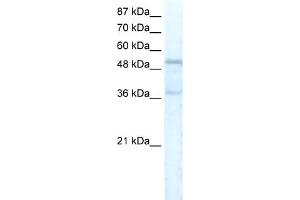 WB Suggested Anti-FOXC1 Antibody Titration:  5. (FOXC1 antibody  (C-Term))