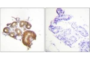 Immunohistochemistry analysis of paraffin-embedded human skin tissue, using ETK (Ab-40) Antibody. (BMX antibody  (AA 6-55))