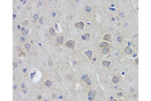 Immunohistochemistry analysis of paraffin-embedded mouse brain using DLG4 Polyclonal Antibody at dilution of 1:100. (DLG4 antibody)