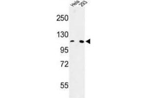 Western blot analysis of MTTP (arrow) in Hela, 293 cell line lysates (35ug/lane) using MTTP Antibody (C-term).