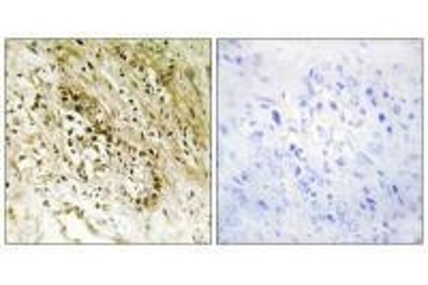 PDZD2 antibody