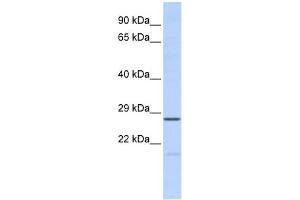 WB Suggested Anti-MED6 Antibody Titration:  0. (MED6 antibody  (Middle Region))