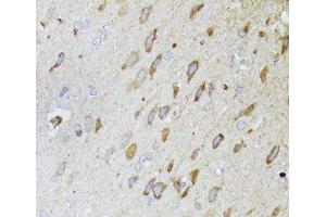 Immunohistochemistry of paraffin-embedded Rat brain using MT-ND5 Polyclonal Antibody at dilution of 1:100 (40x lens). (MT-ND5 antibody)
