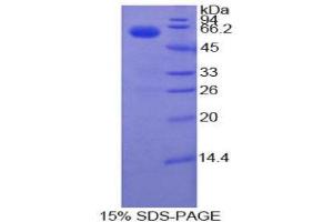 SDS-PAGE (SDS) image for Coagulation Factor VII (F7) (AA 193-447) protein (His tag,GST tag) (ABIN2122660) (Factor VII Protein (AA 193-447) (His tag,GST tag))