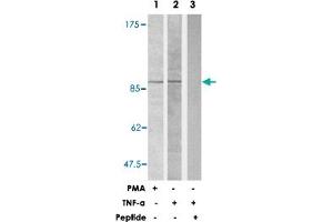 Western blot analysis of extracts from HUVEC cells using ICAM1 polyclonal antibody . (ICAM1 antibody)