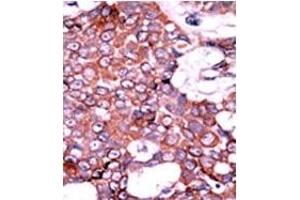 Image no. 2 for anti-Cell Division Cycle 25 Homolog A (S. Pombe) (CDC25A) (pSer76) antibody (ABIN358097) (CDC25A antibody  (pSer76))