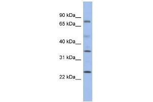 WB Suggested Anti-PPM1K Antibody Titration: 0. (PPM1K antibody  (Middle Region))